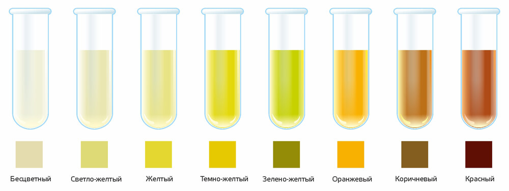 urinacolor(1).jpg